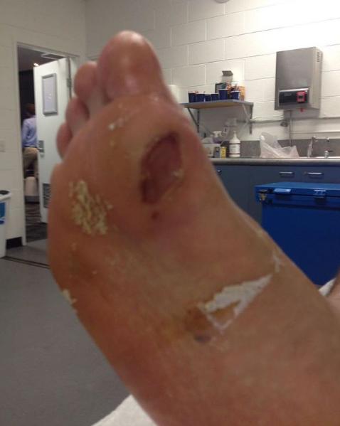 Chung, une saison de blessures